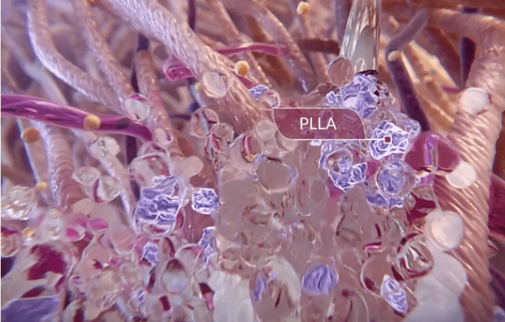 PLLA童颜针成分OEM贴牌:再生抗衰赛道的百亿级新机遇